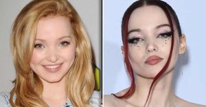 dove cameron plastic surgery 1