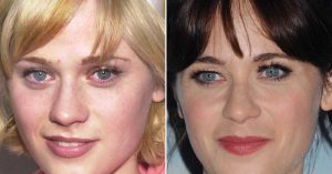 zooey deschanel plastic surgery 2