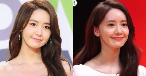 Yoona Plastic Surgery