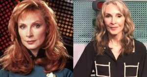 gates mcfadden plastic surgery