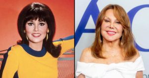 marlo thomas plastic surgery