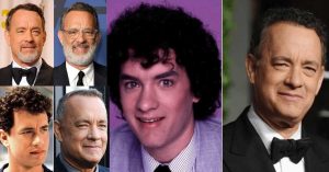 tom hanks plastic surgery