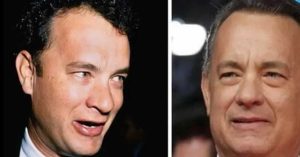 tom hanks plastic surgery