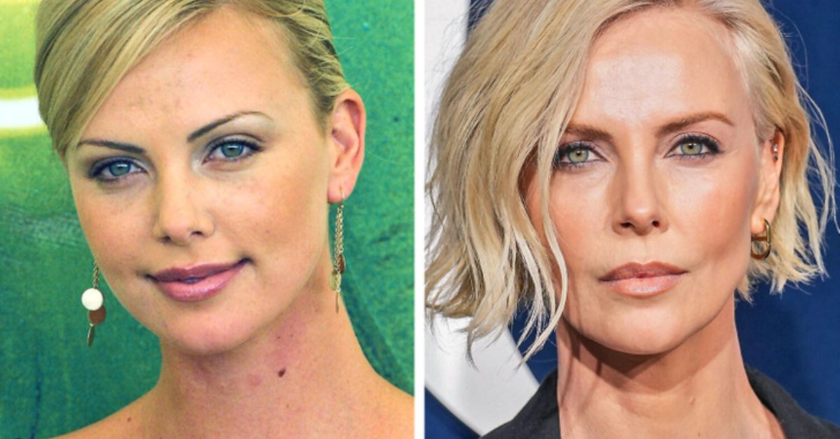 charlize theron plastic surgery 