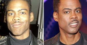 did chris rock have plastic surgery