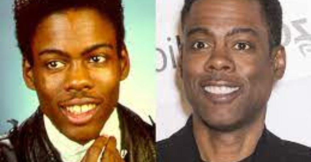 did chris rock have plastic surgery