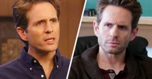 glenn howerton plastic surgery