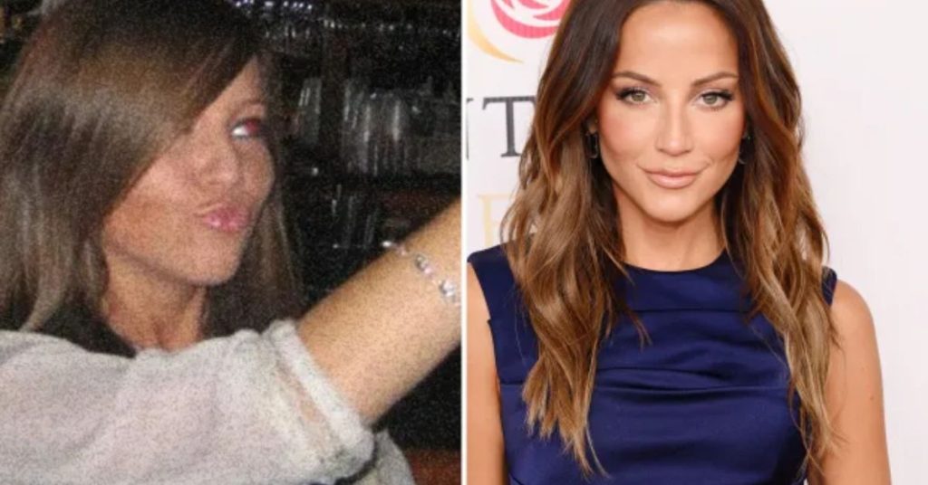 kay adams plastic surgery