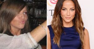 kay adams plastic surgery