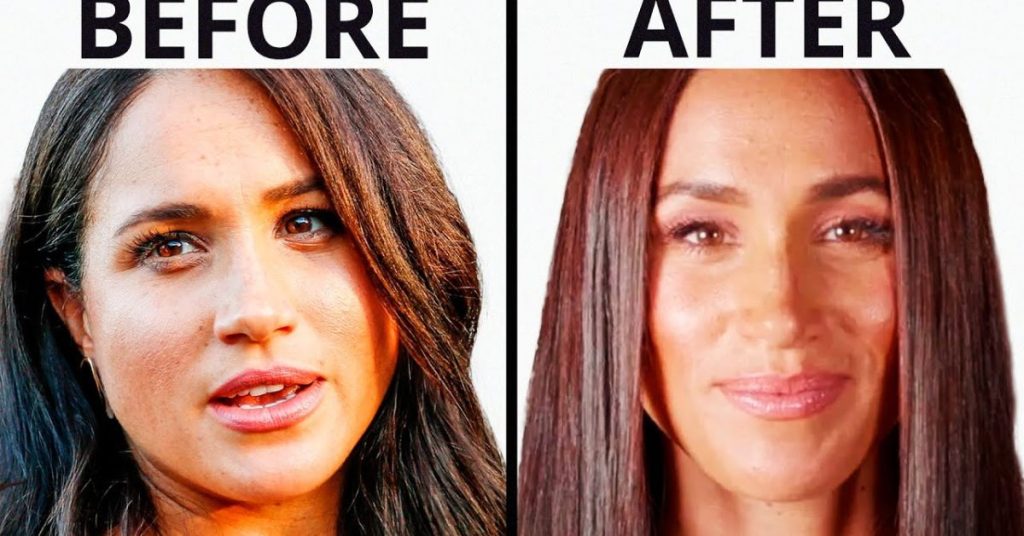 meghan markle plastic surgery