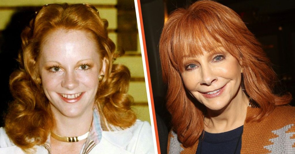 reba mcentire plastic surgery