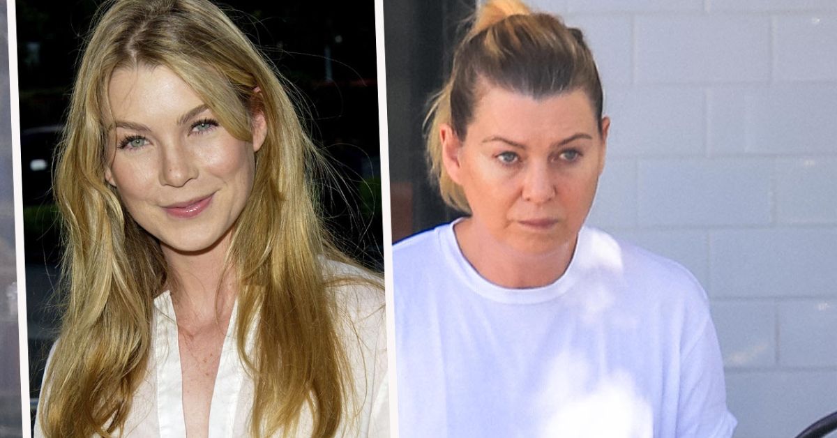 ellen pompeo plastic surgery