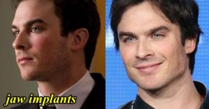 ian somerhalder surgery