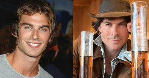 ian somerhalder surgery