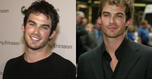 ian somerhalder surgery