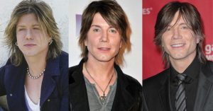 johnny rzeznik plastic surgery 1