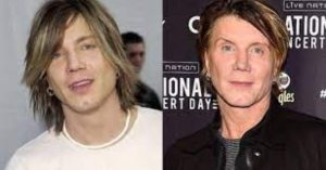 johnny rzeznik plastic surgery