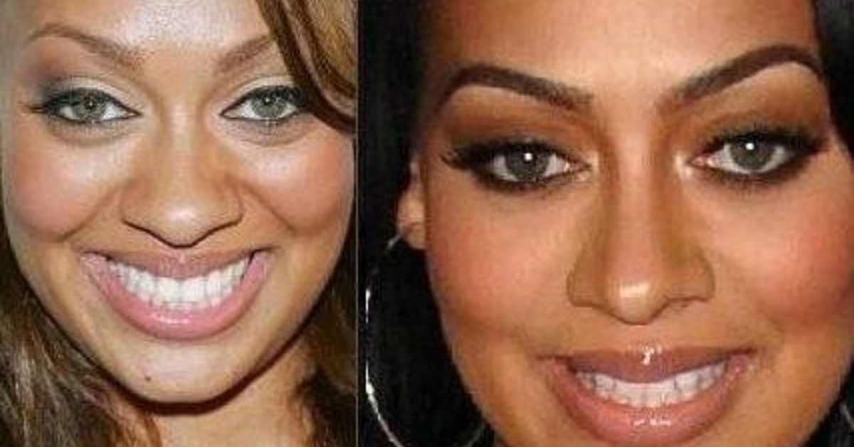 Did Lala Anthony Secretly Undergo Plastic Surgery to Enhance Her Look?