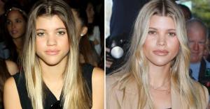 sofia richie plastic surgery 1