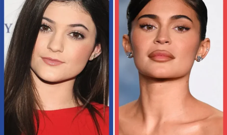 Exploring the Impact of Cosmetic Procedures on Kylie Jenner’s Career and Life