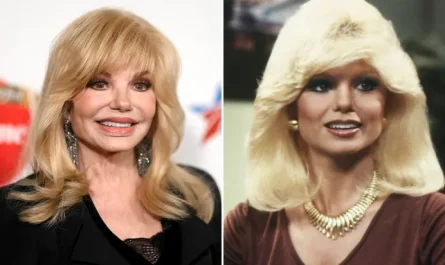 Loni Anderson