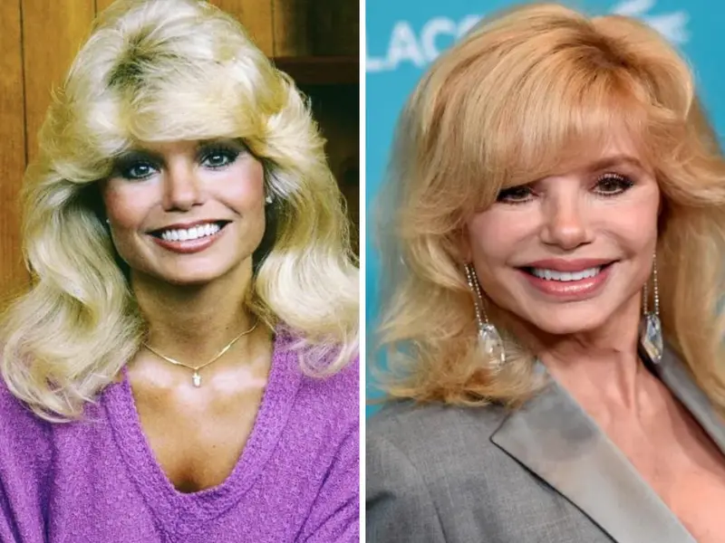 Loni Anderson